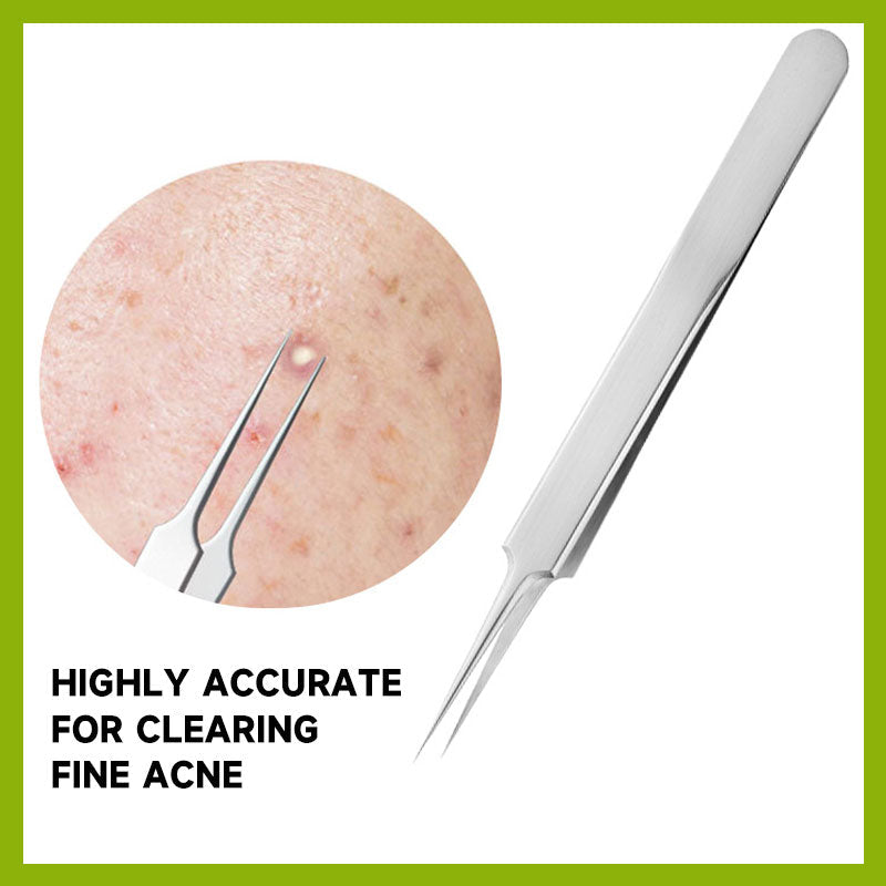 HOT SALE 49% OFF💥Professional Facial Blackhead Remover Tweezers